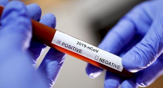 В Казахстане за сутки выявлен 781 случай заболевания пневмонией с признаками COVID-19