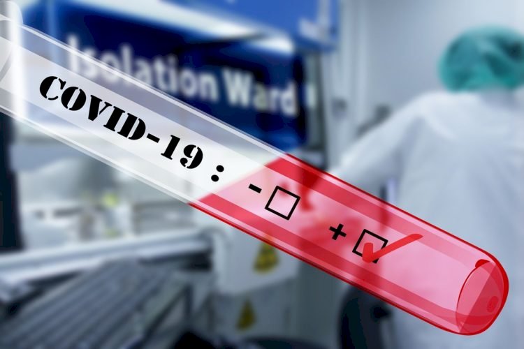 В Казахстане зарегистрировано 776 новых пациентов с COVID-19