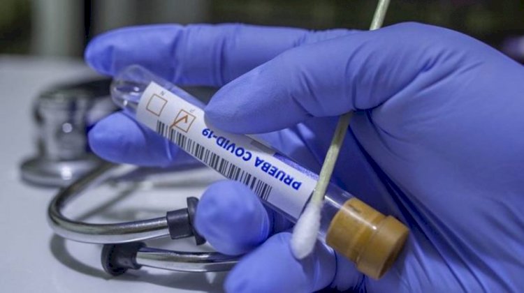 В Казахстане за сутки коронавирусом заболели 795 человек