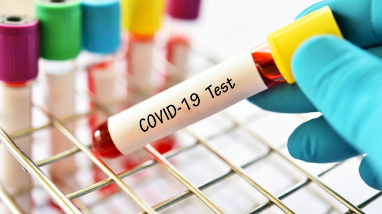 За сутки в Казахстане выявили 78 случаев заболевания COVID-19