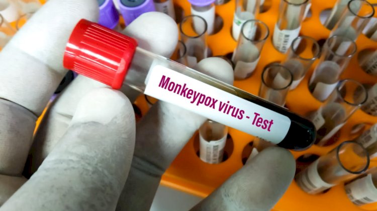 Может ли вспышка обезьяньей оспы быть следствием атаки биотеррористов