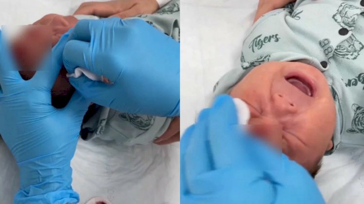 Глава Минздрава Ажар Гиният прокомментировала видео с хиджамой младенцу