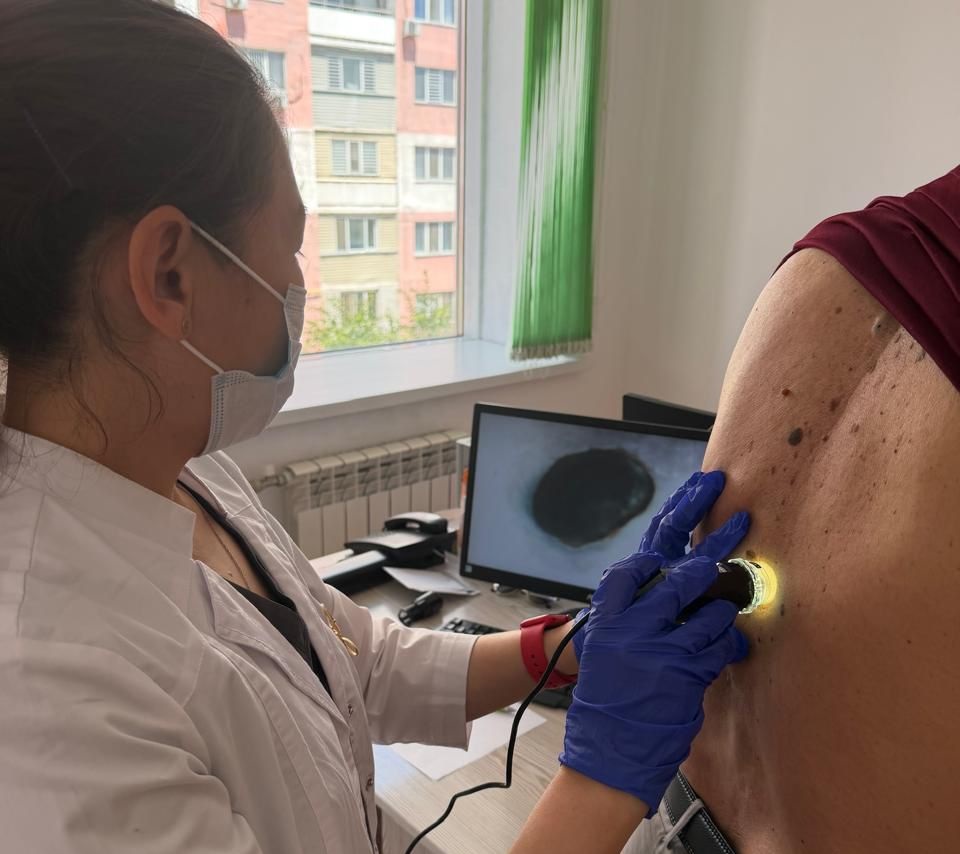 В онкоцентре Алматы провели день открытых дверей по профилактике рака кожи